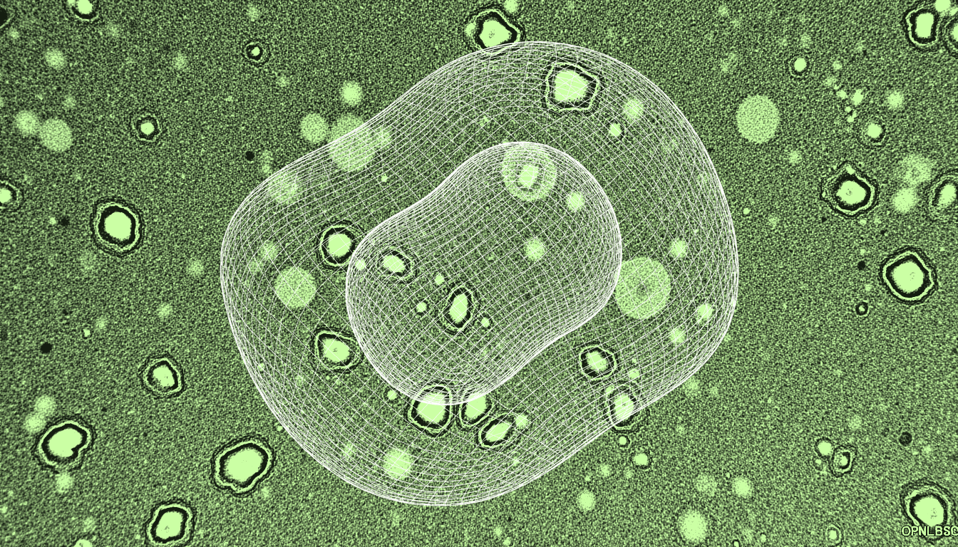 clustered lysosomes with membrane attack complex insertion, deep indigo stain, high-resolution transmission electron micrograph